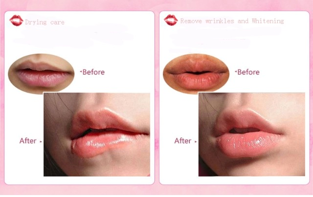 Lip Gel Mask